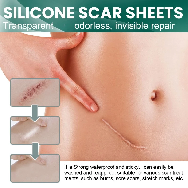 Silicone Scar Patch Skin Repair Sheets Removal Self-Adhesive Stretch Mark Tape Therapy Burn Acne Scar Care invisible sticker