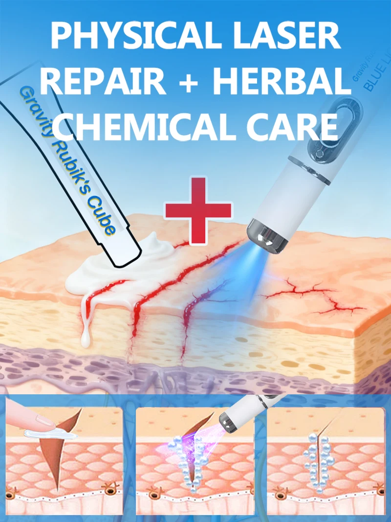 เครื่องมือลดรอยแตกลายด้วยแสงสีฟ้า ลาก่อนรอยแตกลาย เครื่องมือดูแลผิวสำหรับคุณแม่