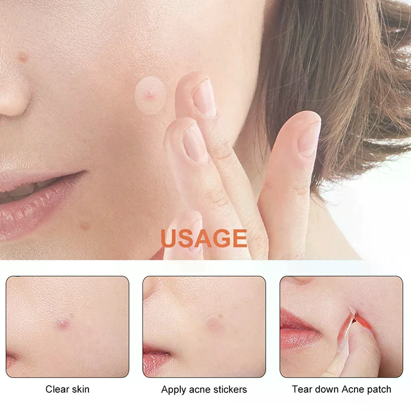 Riparazione del viso Acne Pulisci i pori Idratare e pelle liscia Patch per l'acne Adesivi per il viso Strumenti per la cura della pelle