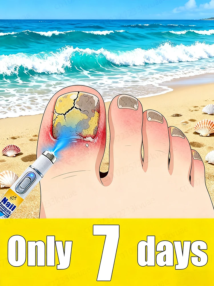 

Отправить из онихомикоза в 7-дне годы, не отправляйте его, оттенкийте свою жизнь.