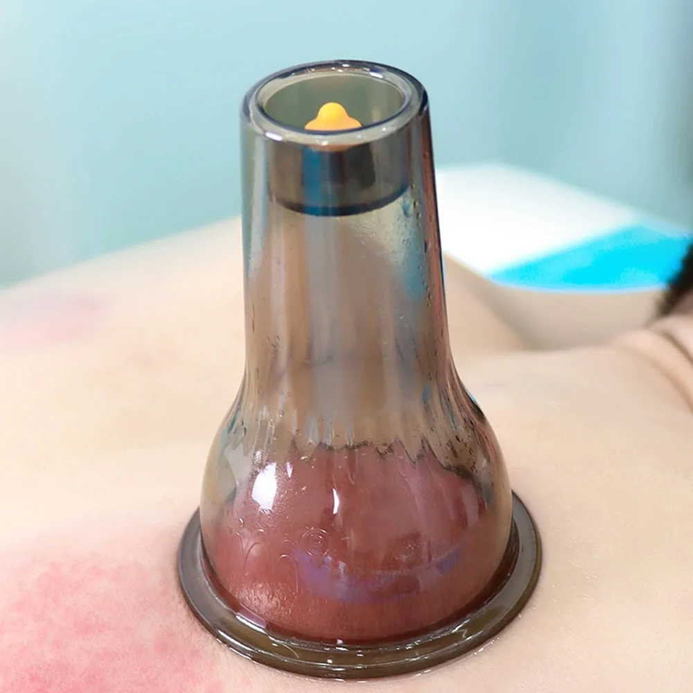 

Цельный вакуумный набор для китайской медицины, профессиональный терапевтический набор для массажа кожи, сжигатель жира для похудения, умные банки от целлюлита