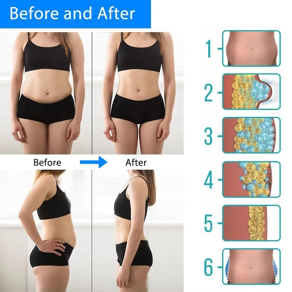 NEW Cryotherapy Dissolve Fat Cold Therapy Anti Cellulite Massager Abdominal Lipo Freeze Machine Fat Lose Removal Body Slimming