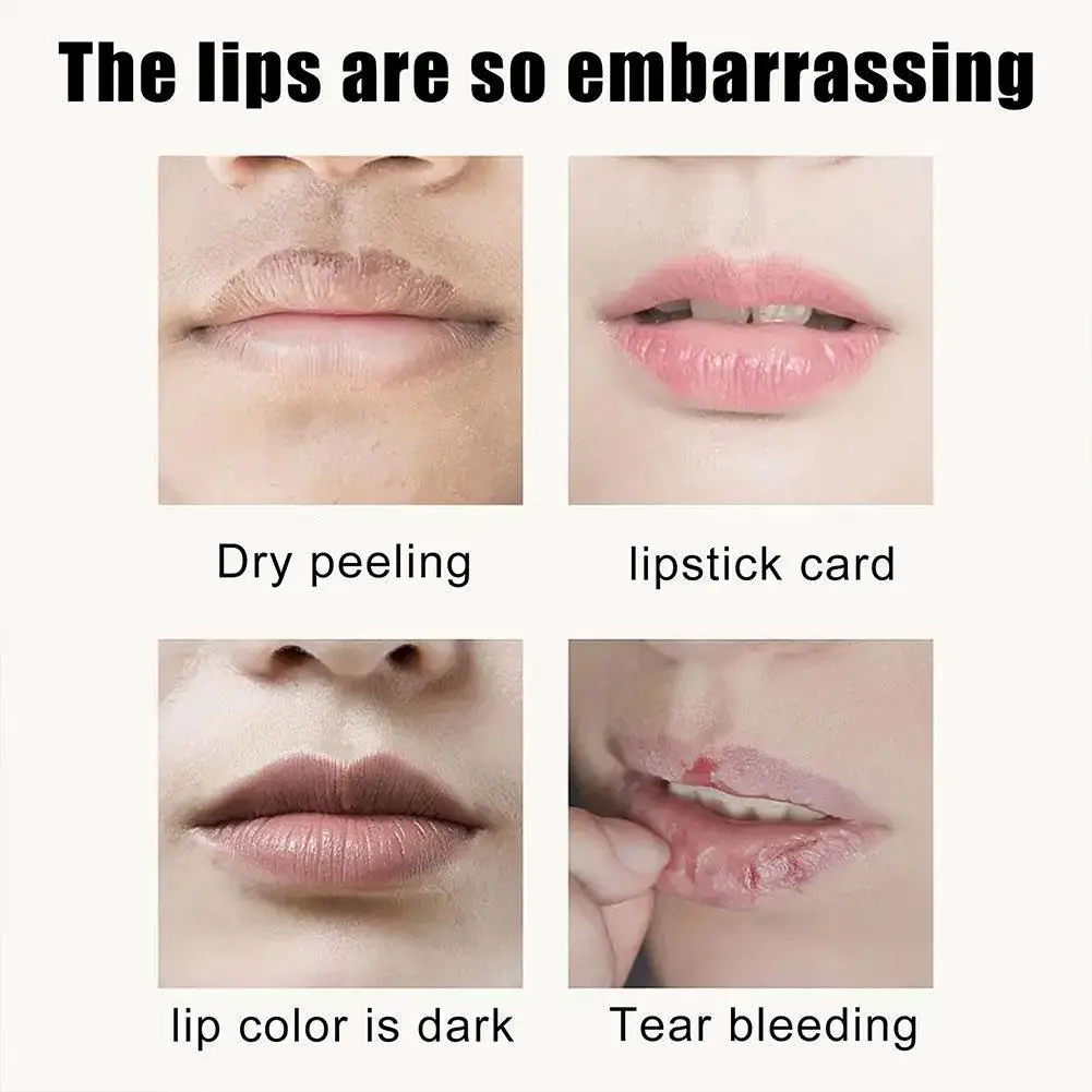 Lips Moisturizing Gel Exfoliating Remove Dead Skin Smooth Lines Fine Nourish Care Whitening Lips 8g Lips Lightening U4E1