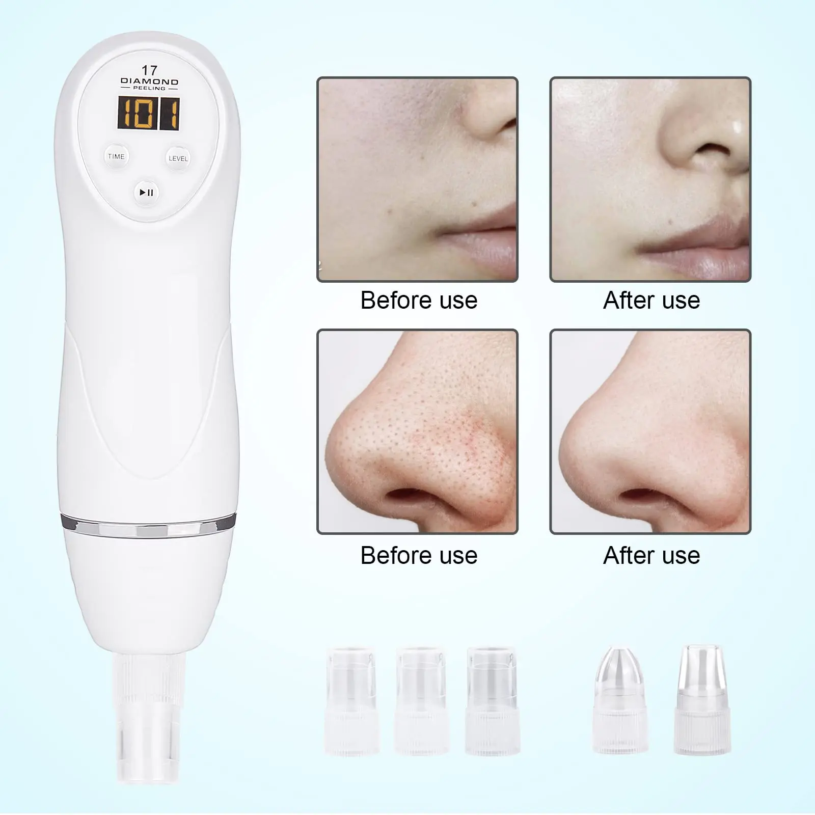 Diamond Microdermabrasion Machine Blackhead Remover Vacuum Facial Pore Cleaner Electric USB with 8 Probes Skincare Tool Home Use