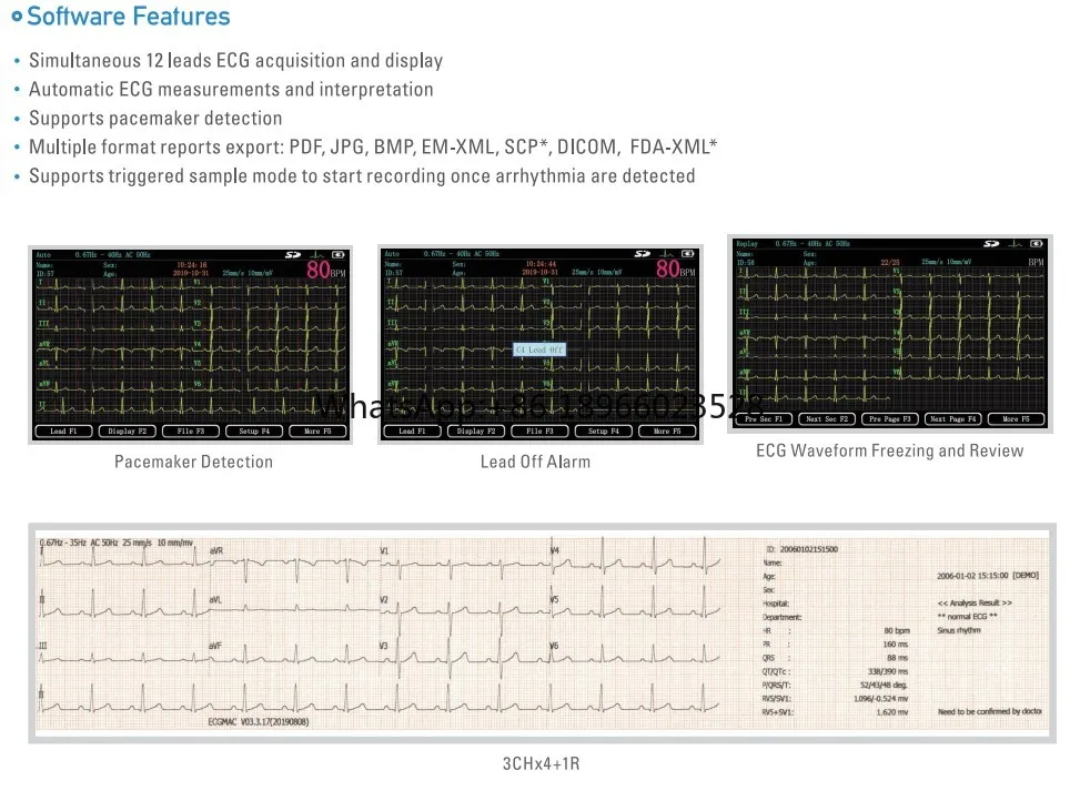 Good Price Portable Ecg 3 Channel Ecg Device Electrocardiograph Machine Ecg Machine