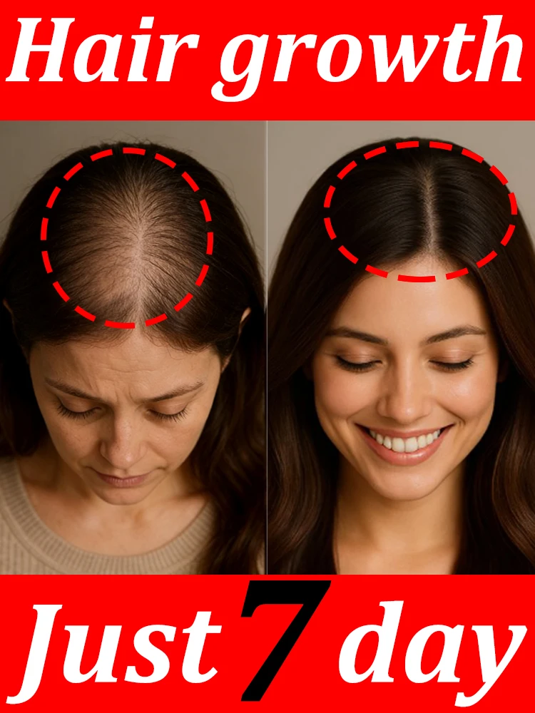 

Gᴇɴᴛʟᴇ ɴᴏᴜʀɪsʜɪɴɢ sᴘʀᴀʏ BOON! hair spreads like wildfire