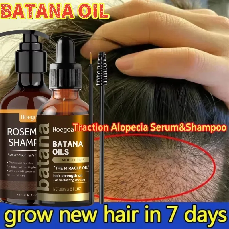 

Fast Hair Growth Set Batana Oil Traction Alopecia Serum&Shampoo Anti Break Loss Hair Growth Baldness Treatment Hair Health Care