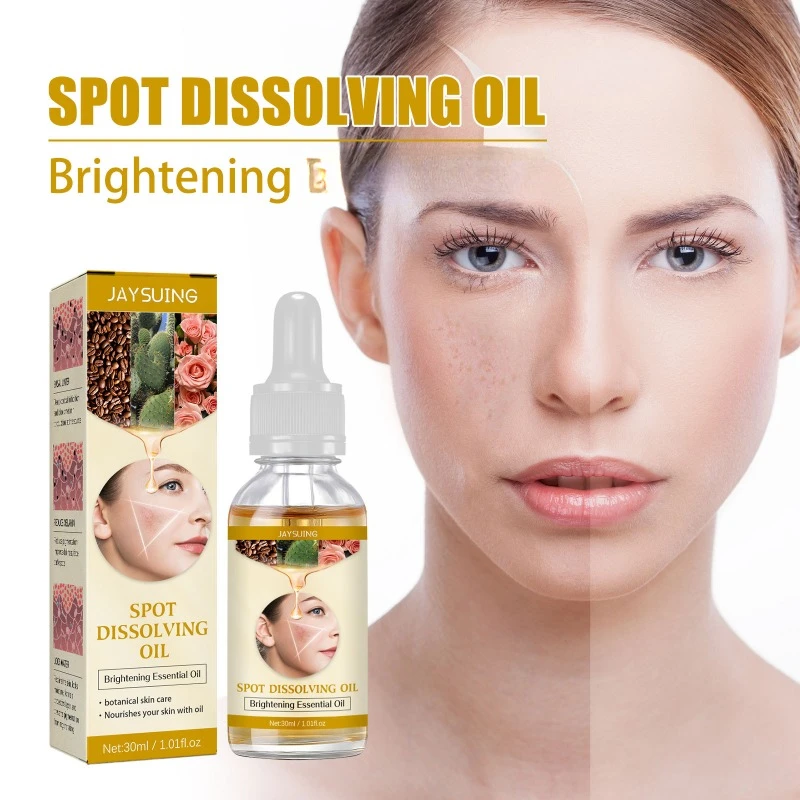 Spot Dissolving Oil Anti Spot Freckle Remover Fade Pigmentation Brightening Melanin Lightening Melasma Whitening Freckle Serum