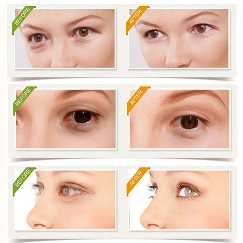 Sturgeon Seed Eye Essence Ampoule Capsule Skin Care Anti-Wrinkle Remover Dark Circles Eye Serum Eye Patches Fine Lines Eye Cream