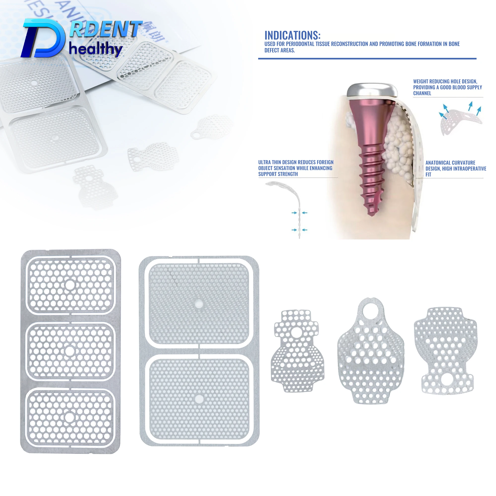 

Титановая сетка для дентальной имплантации, гибкая мембрана GBR, барьер для регенерации кости при пародонтальной реконструкции