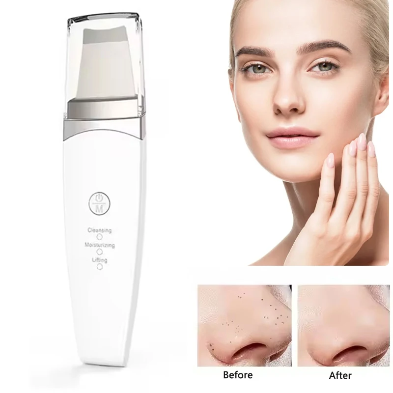 Depurador ultrasónico de la piel, espátula Facial con vibración, eliminador de espinillas, limpieza Facial profunda, máquina de elevación, pala peladora, limpiador de poros