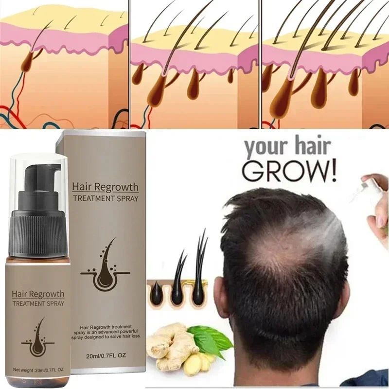 

Fast Hairs Growth Oil Baldness Repair Hereditary Hair Loss Postpartum Hair Loss Seborrheic Hairs Loss Hair Oil Fast Hairs Growth