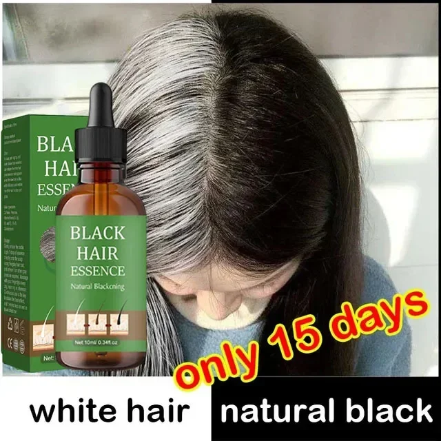 Natural and Healthy White To Black hair No hair color,no allergies Anti-grey quickly turns white hair into black repairs NEW0903