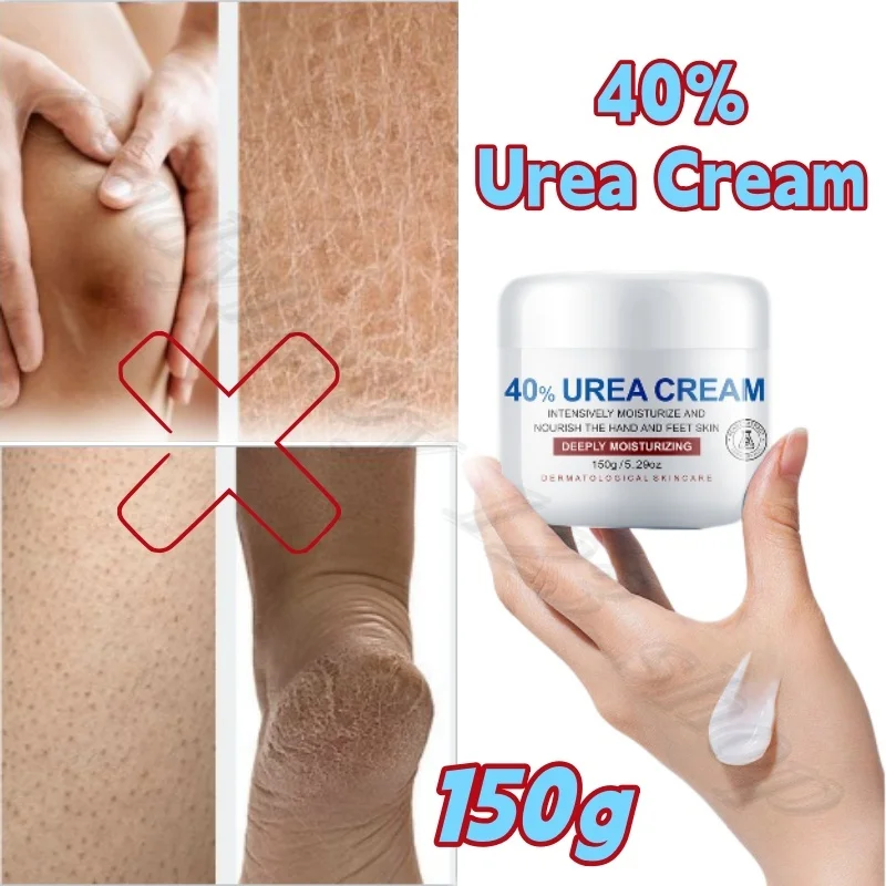 40% Urea Cream Moisturizing and Relieving Dry Skin Body Cream to Prevent Hand and Foot Cracking 150g
