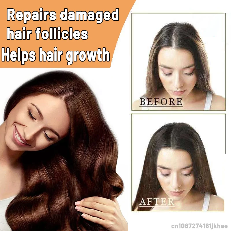 

Лысая убийца, так, что был не будет больше облысения в мире.