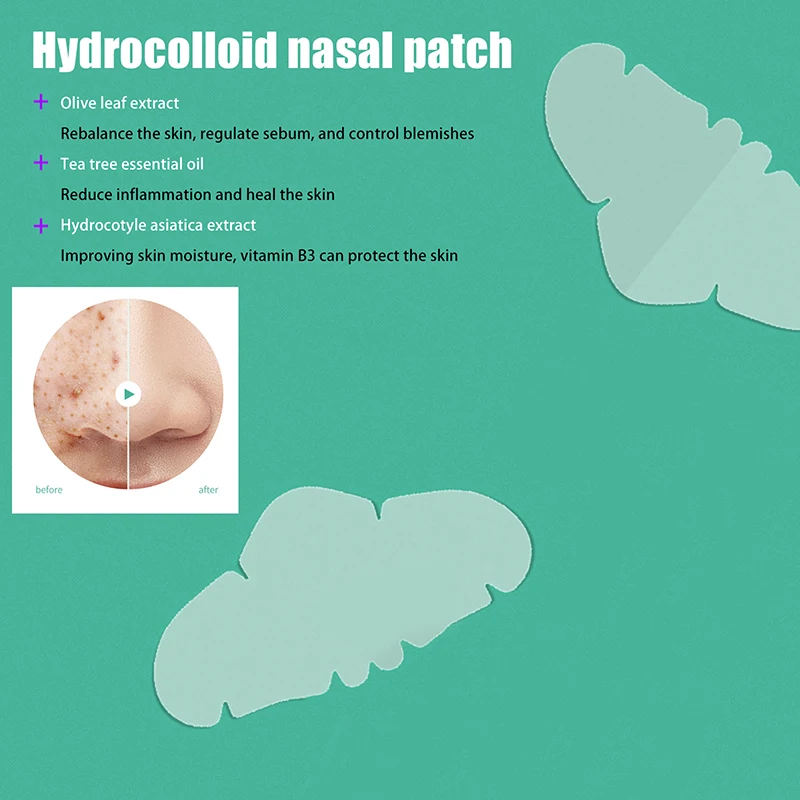 Remendos hidrocolóides para espinhas, zona t, poros, testa, nariz e queixo, remendo hidrocolóide para cravos, a-cne e oleoso