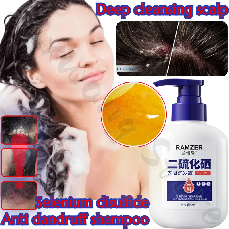 

Selenium Disulfide Anti-Dandruff Shampoo Deep Cleansing Scalp Oil Control Anti-Dandruff Anti-Itching Smoothing Shampoo 320ml