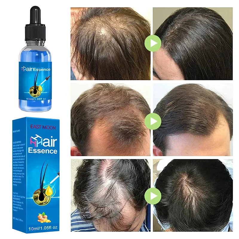 Fast Hair Growth Serum Spray Anti Hair Loss Prevent Baldness Scalp Treatment Repair Roots Beauty Health Hair Care For Men Women