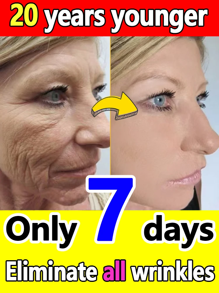 

For Wrinkles, 20 Years Younger,Autumn and winter cream