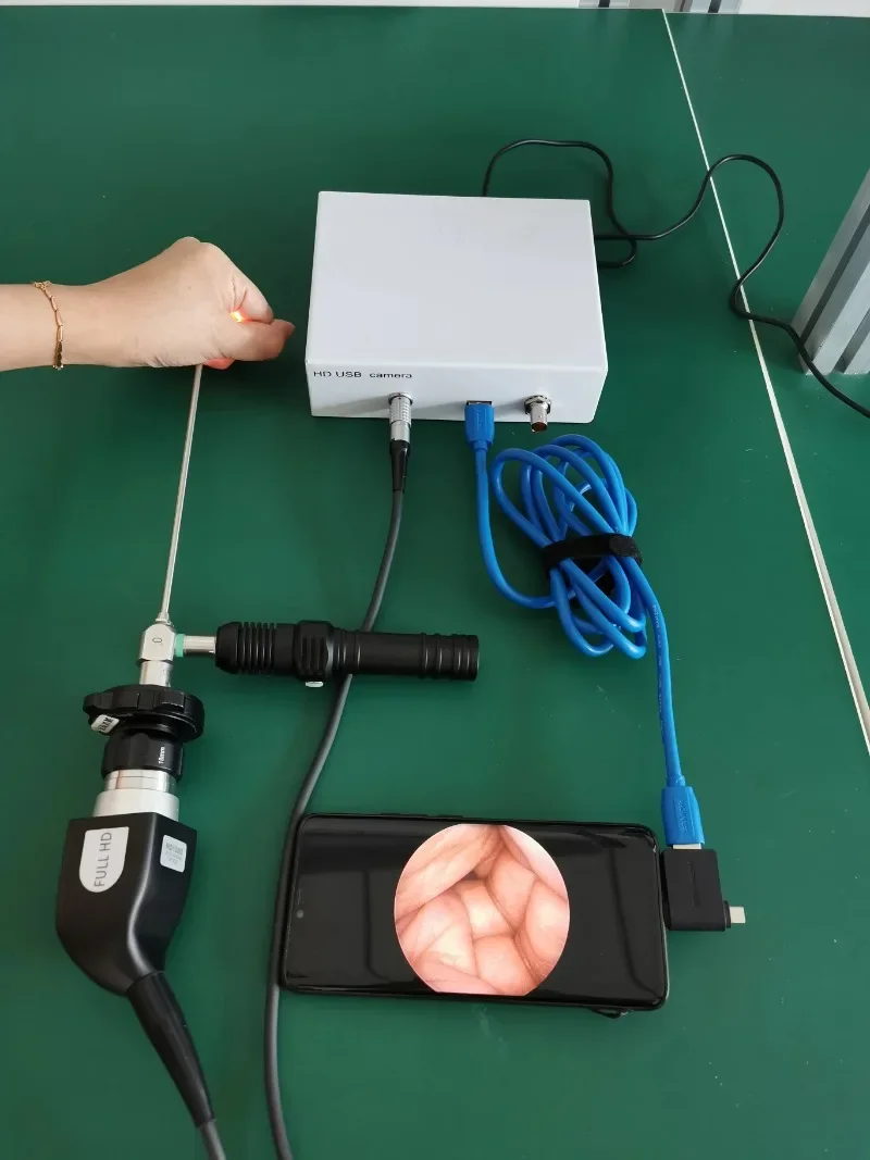 harga laringoskop video hd endoskopi