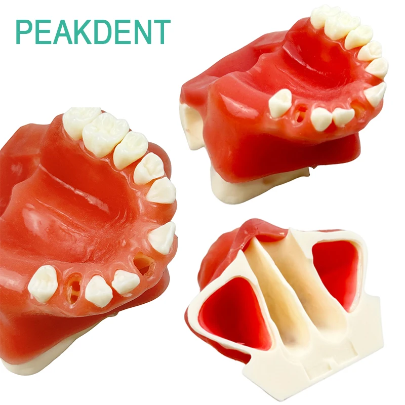 

Модель зубного имплантата, отсутствующая верхнечелюстная синусная модель для практики размещения зубов, обучающая практичная обучающая модель для стоматологии