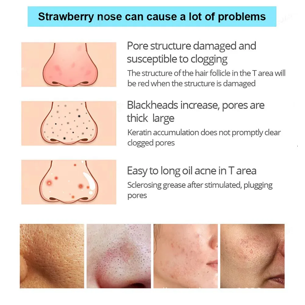 Parche de nariz de cerdo negro hecho de carbón de bambú para eliminar puntos negros, acné, limpiar los poros y absorber las manchas de aceite, 5/10/15/20/30 Uds.