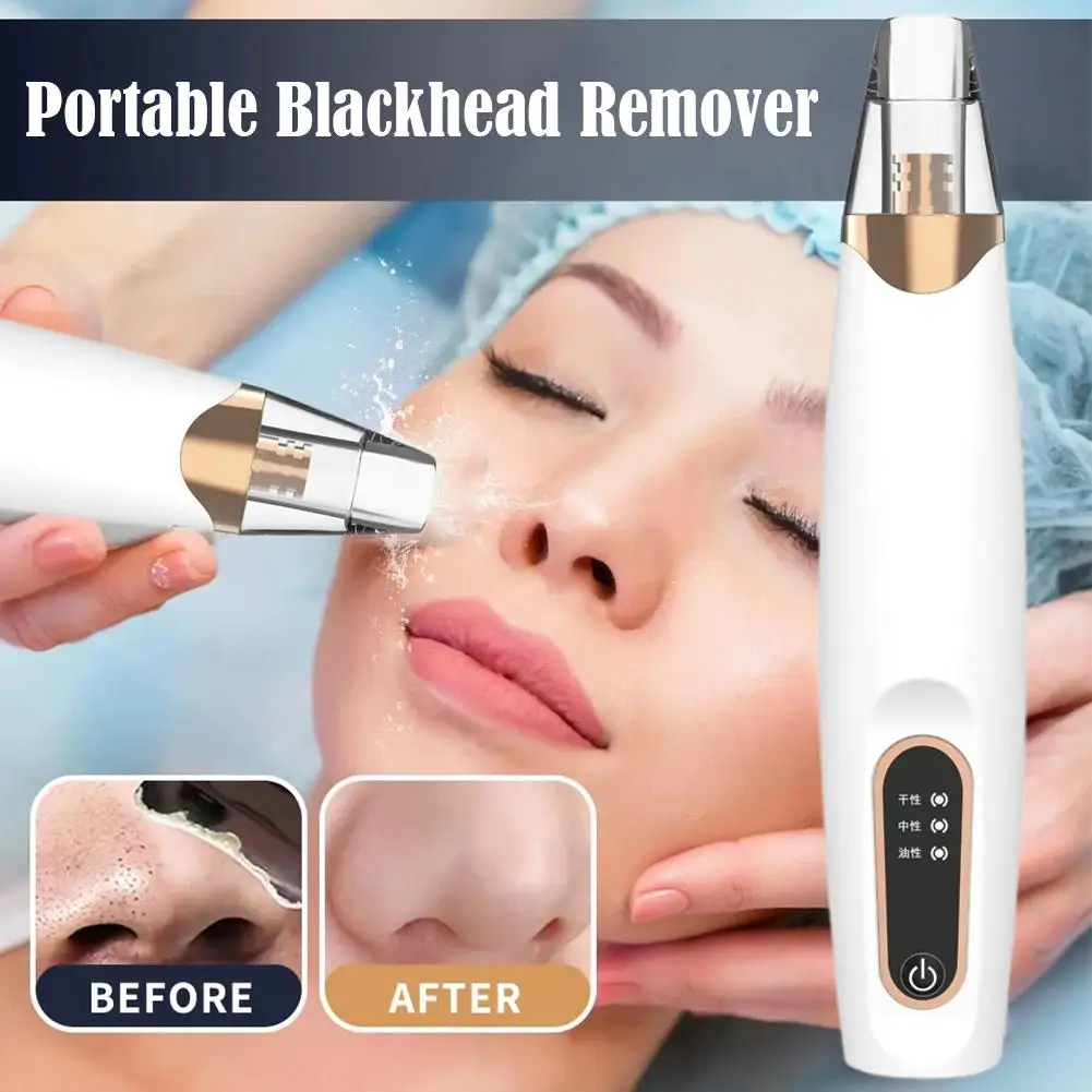 Aspirateur électrique Portable pour éliminer les points noirs, nettoyeur de pores du visage, points blancs, extracteur de boutons et d'acné, Instrument de soins de la peau