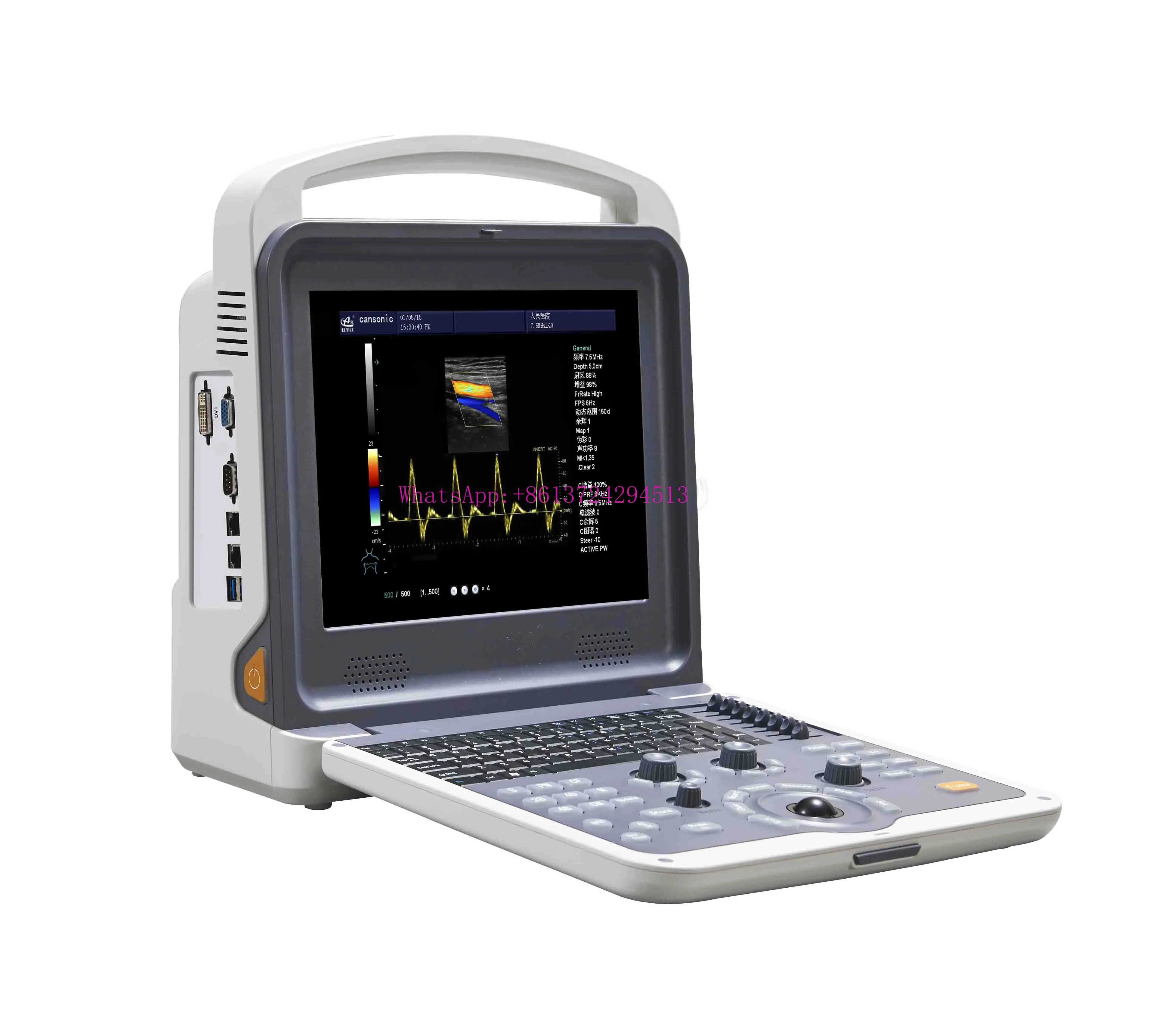 

YSB-K2000 Cheap Price Ultrasound 4d Portable Color Doppler Ultrasonic Machine Ultrasound Scanner System