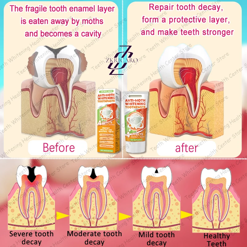 Risolvi problemi di carie dei denti e mantengono i denti sani