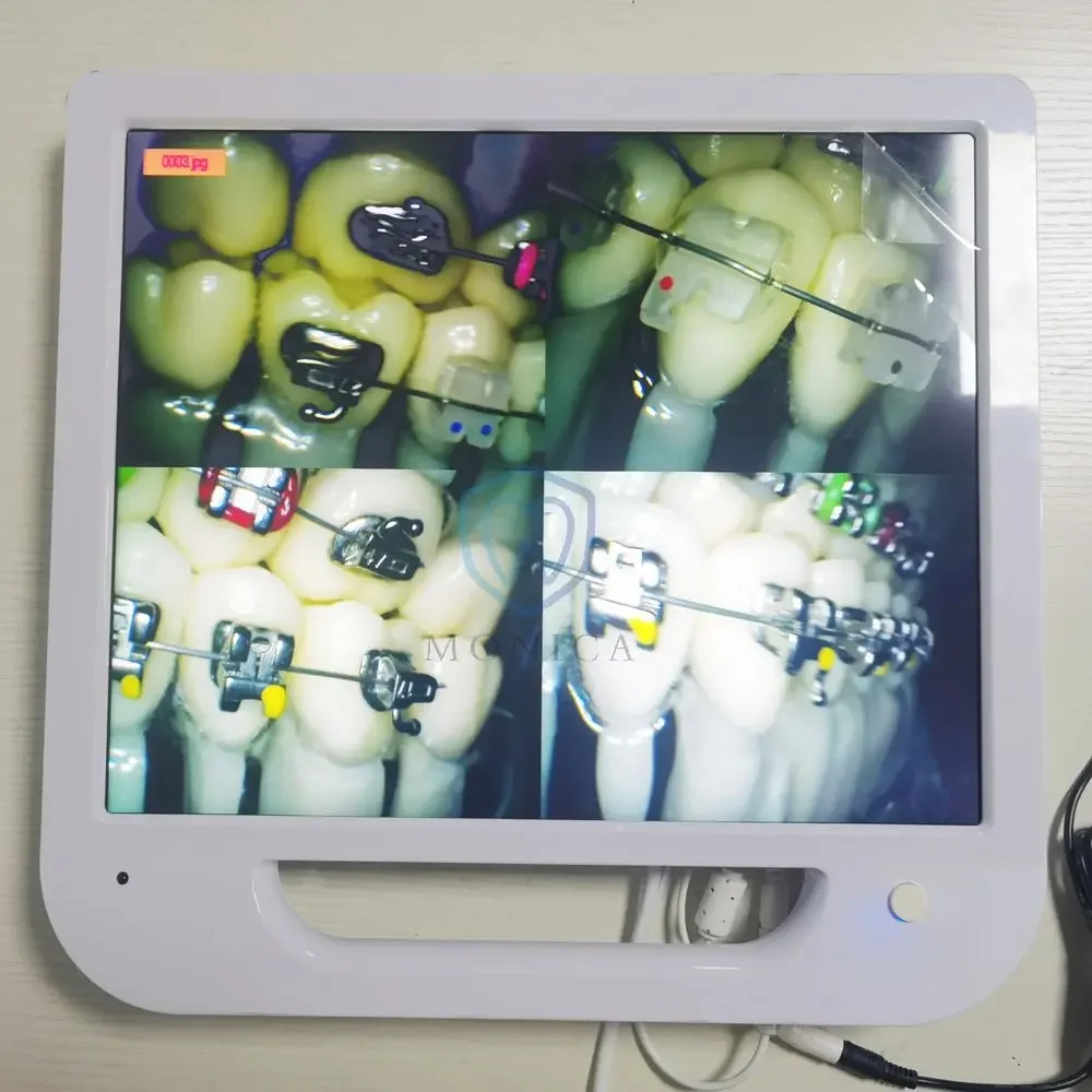 Sistema intraoral de 17 polegadas de alta qualidade com tela/Tudo em um com e suporte/