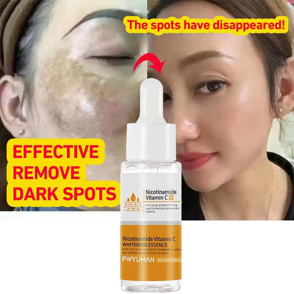 

Vitamin C Remove Freckles Dark Spots Serum Effective Whitening Fade Melasma Melanin Brighten Repair Dull Skin Care Cosmetics