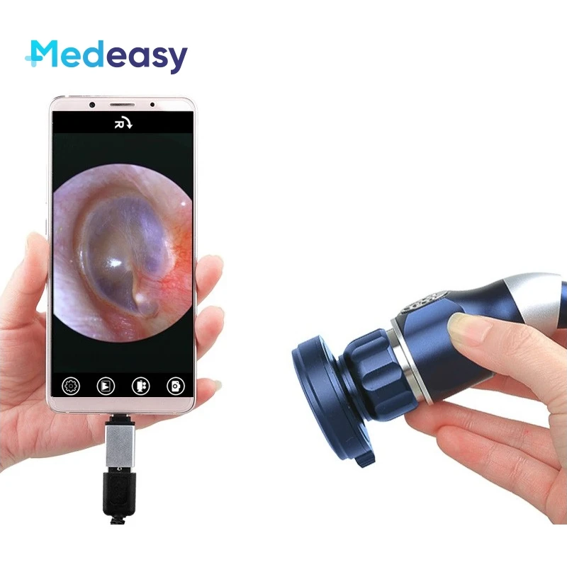 

Medical USB Endoscope Camera for ENT Surgery, Waterproof Portable Endoscope Camera