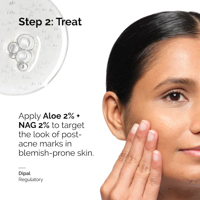 Aloe 2% + NAG 2% Solution Serum 30ml for Post-Acne Marks Improves Skin Texture Supports Strong Protective Barrier