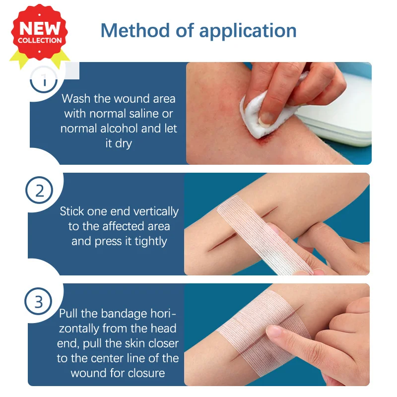 2/3/5 Strip Pita Penutup Luka Perekat Perban Medis Steril Strip Perbaikan Kulit Pertolongan Pertama Pita Bedah Bernapas 10CM