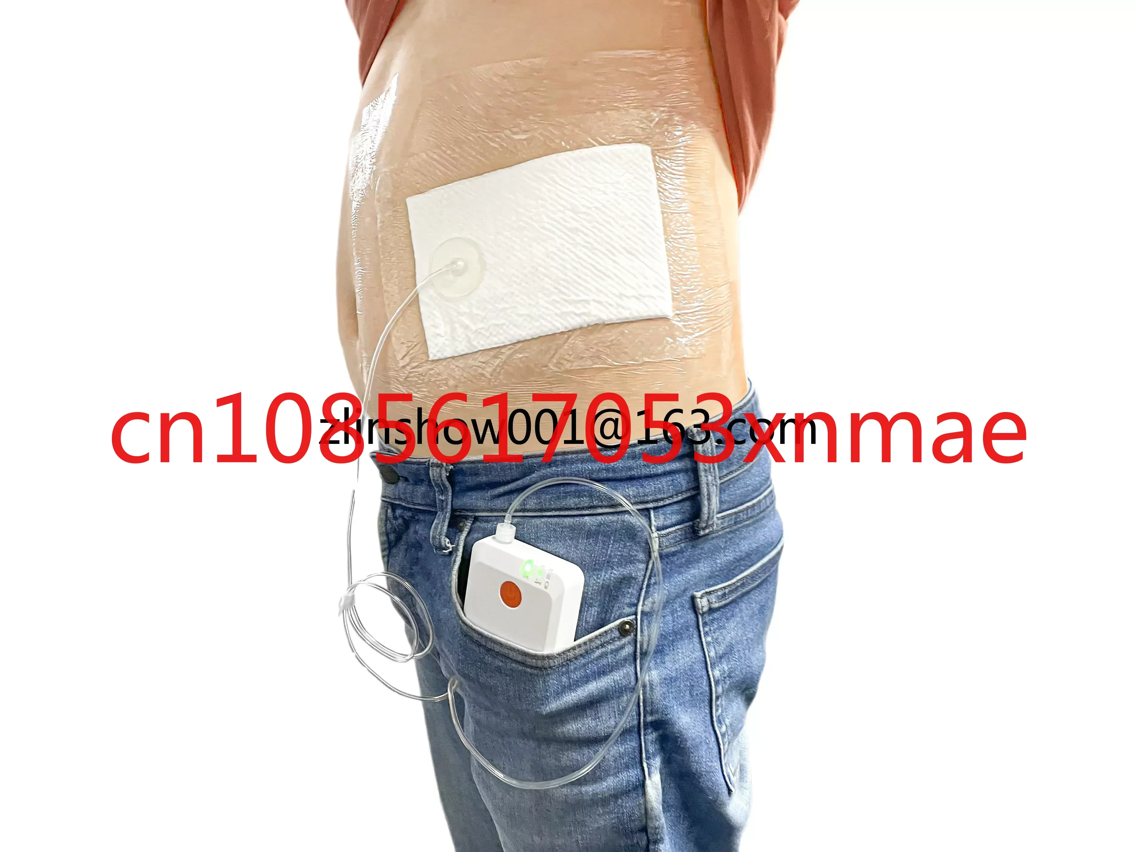 Imagem -04 - Portátil Npwt Pressão Negativa Ferida Terapia Kit Molho Médico Pcs Vestir