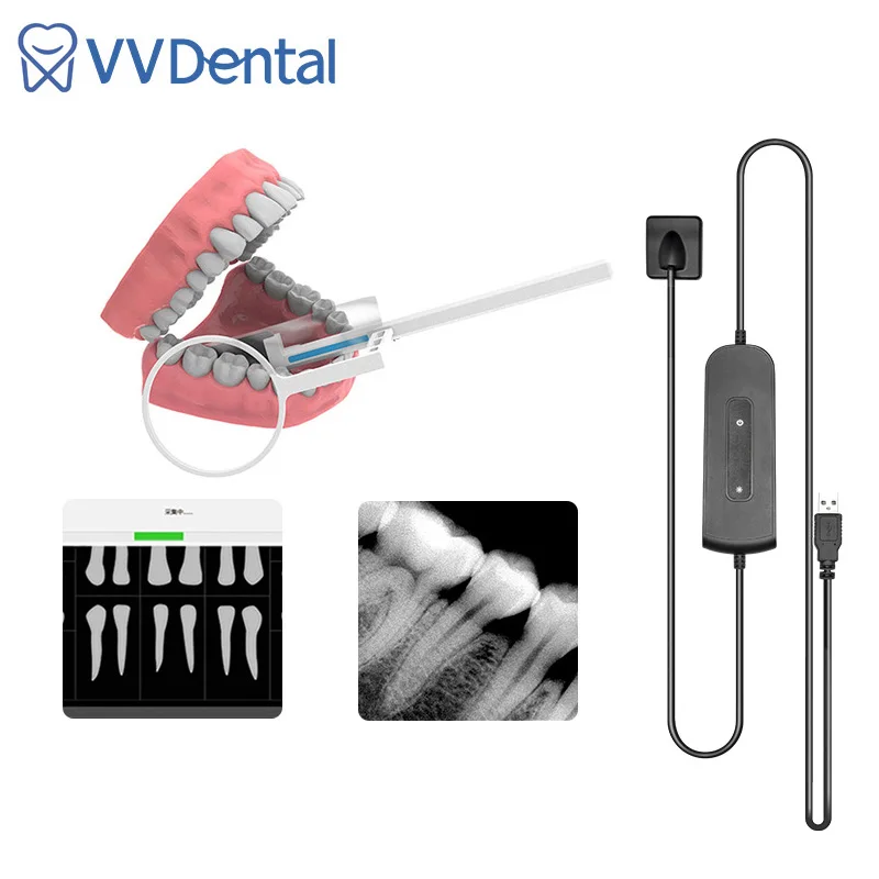 

Dental Tools X Ray Sensor Digital HDR Imaging System RVG Digital Sensor Medical Equipment Intraoral System Image Sensor