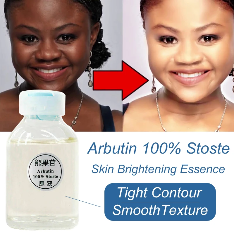 

Arbutin Skin Brightening Essence Liquid Dark Skin Permanent Whitening Serum Kojic Acid Serum Removing Chloasma Fade Dark Spots