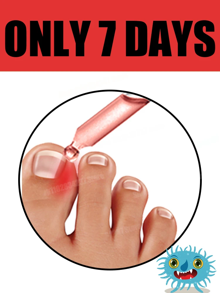 المجدد - تقنية الوقاية من الفطريات - مستشعر التحكم والسلامة القابل للتعديل 80