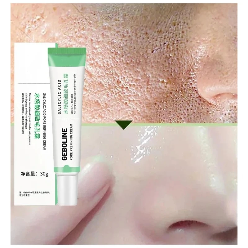 Salicylic Acid Pore Shrinking Face Cream Reduces Pores Tightens Face Smoothes Skin