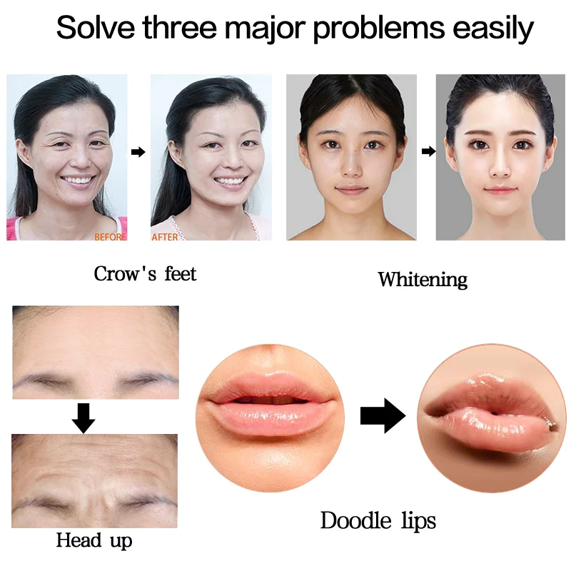 2-in-1 Hyaluron-Pen-Set 0,3ML 0,5ML Zerstäuber Einstellbarer Druckstift Anti-Falten Wasser Hautpflege-Tool Lippenverdickung Heimgebrauch – Detail 9