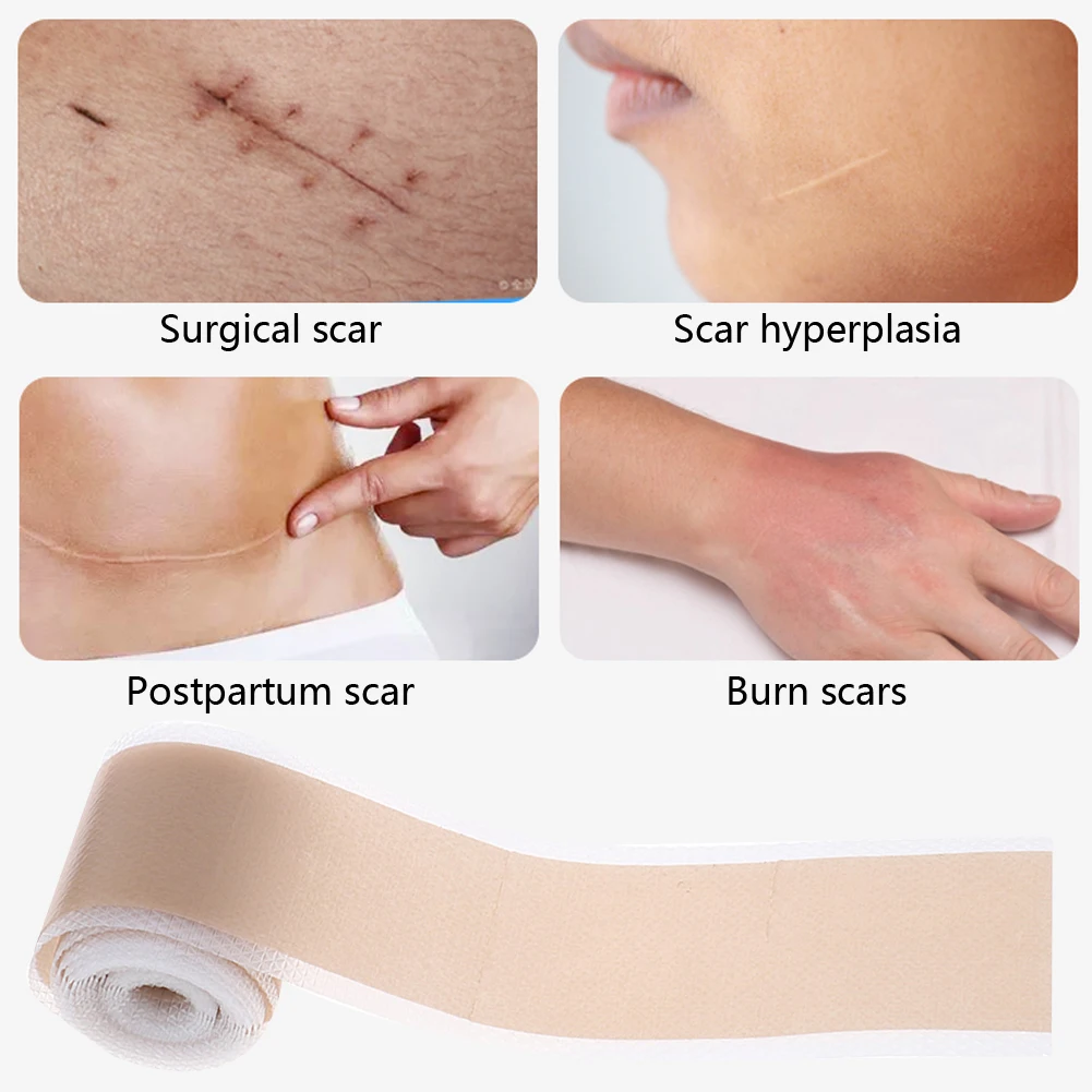 Scar Remoção Silicone Gel Tape, Cirurgia Eficiente, Patch Terapia auto-adesivo, Acne Trauma Burn, Reparação da pele, 50-150cm