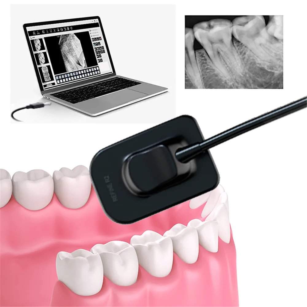 Dental Image Sensor Size1 2 500B 600A Sensor Nanopix1/2 X-ray Imaging System CMOS Vatec XRay Image Digital Device for Dentistry