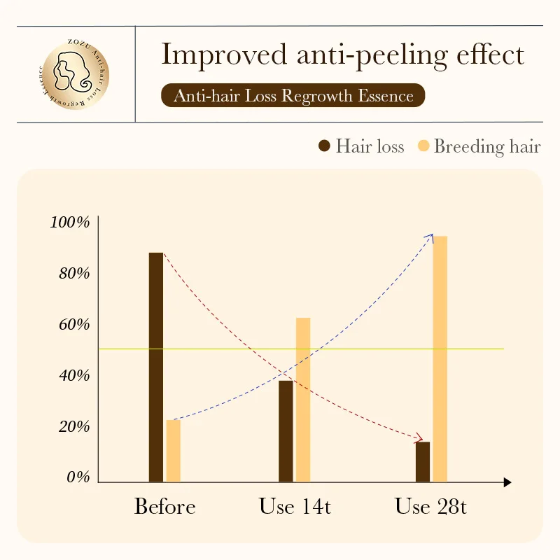 جوهر ZOZU المضاد لتساقط الشعر يجدد جذور الشعر ويحسن جوهر تساقط الشعر والنمو