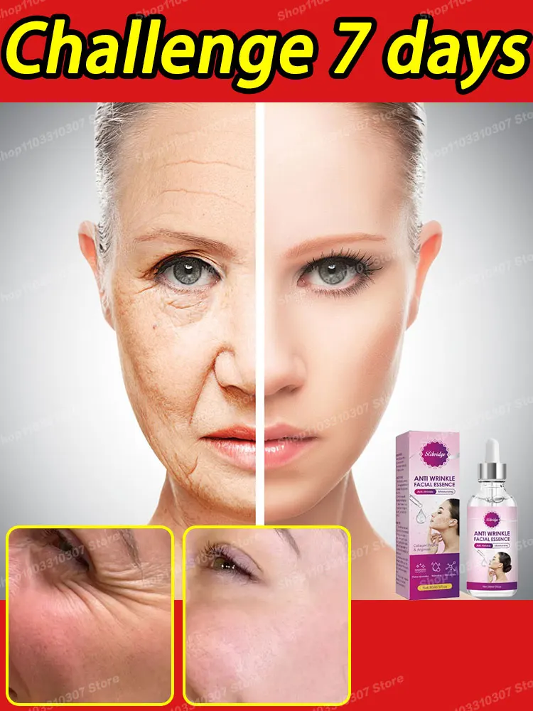 

Eliminate wrinkles Aging Lift Tighten