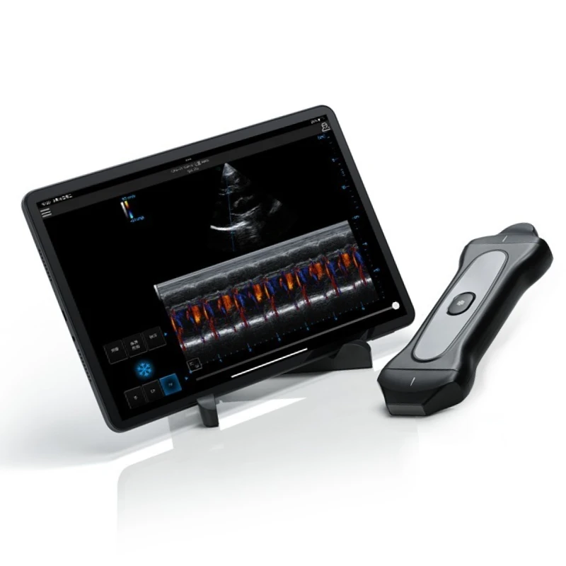 Portable Veterinary Handheld Doppler Ultrasound Handheld Probe Ultrasound Scanner Ultrasound Instrument