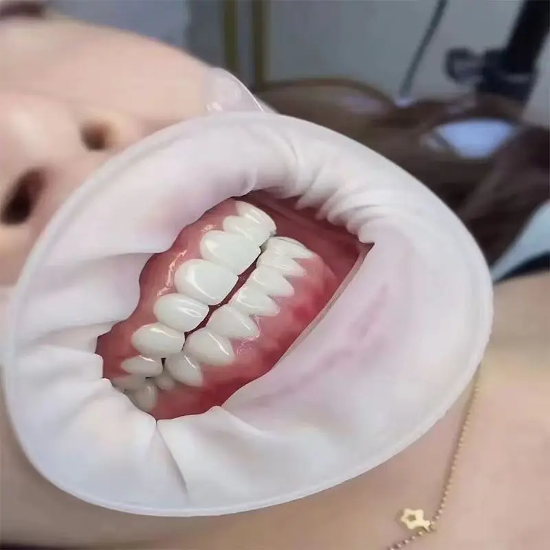 Disposable Oral Expander with Opener Supporting Expanding Teeth Supporting Mouth Device Stereoscopic Beauty Teeth for Children