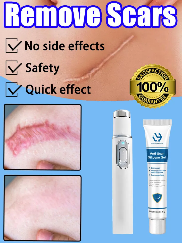 Painless Laser Removes Scars Blue Light Pen