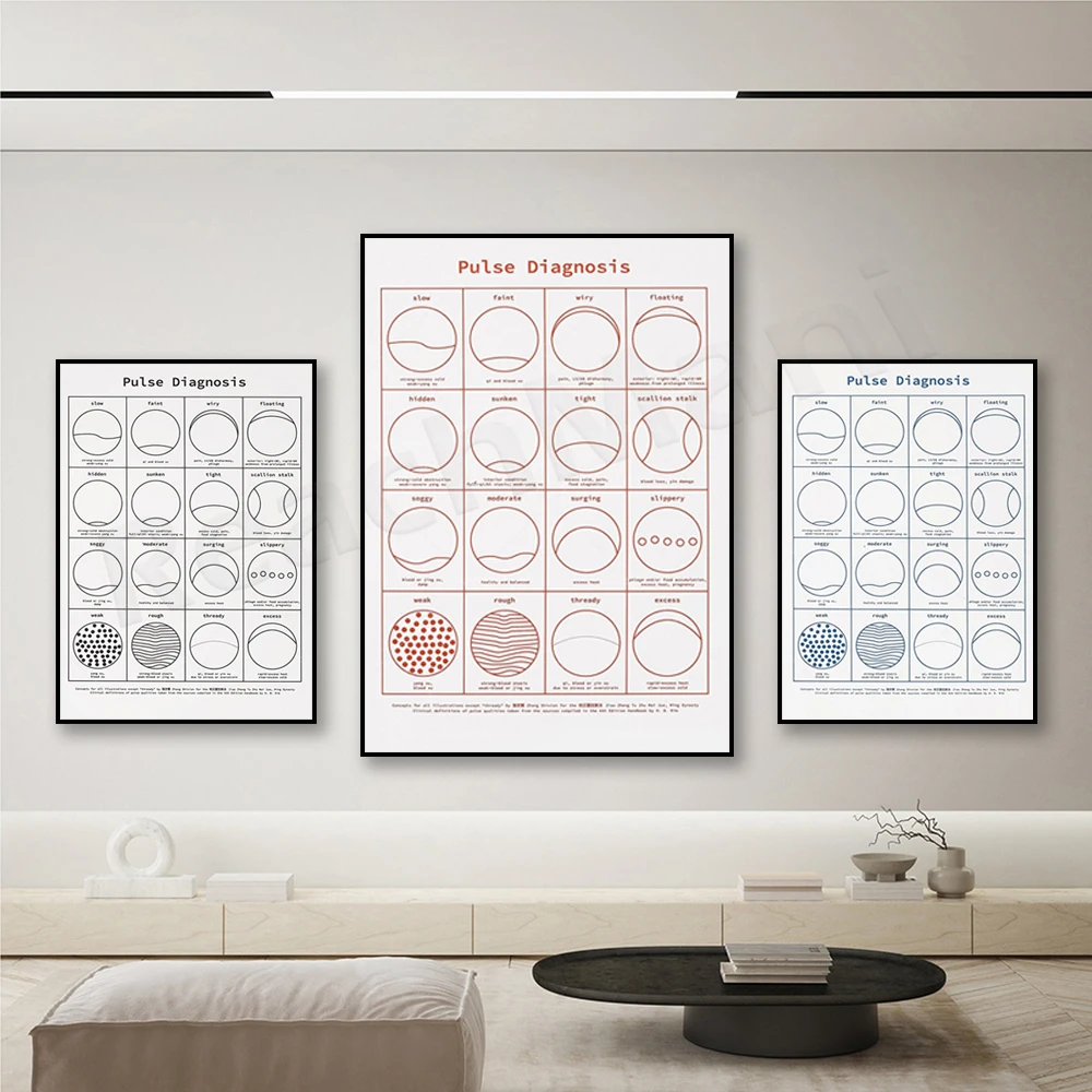 Pulse Diagnosis Print, TCM Acupuncture Anatomy Diagram Poster Canvas Painting Medical Education Image