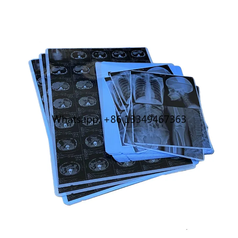

In Stock Medical Equipment Dry Inkjet Digital Xray Films Size 10 X 12 Inches Hot Sale