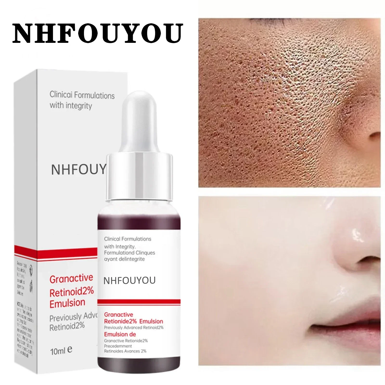 Pore Shrinking Serum Face Removing Large Pores Tightening Repairing Facial Pore Minimizing Essence Skin Care Products